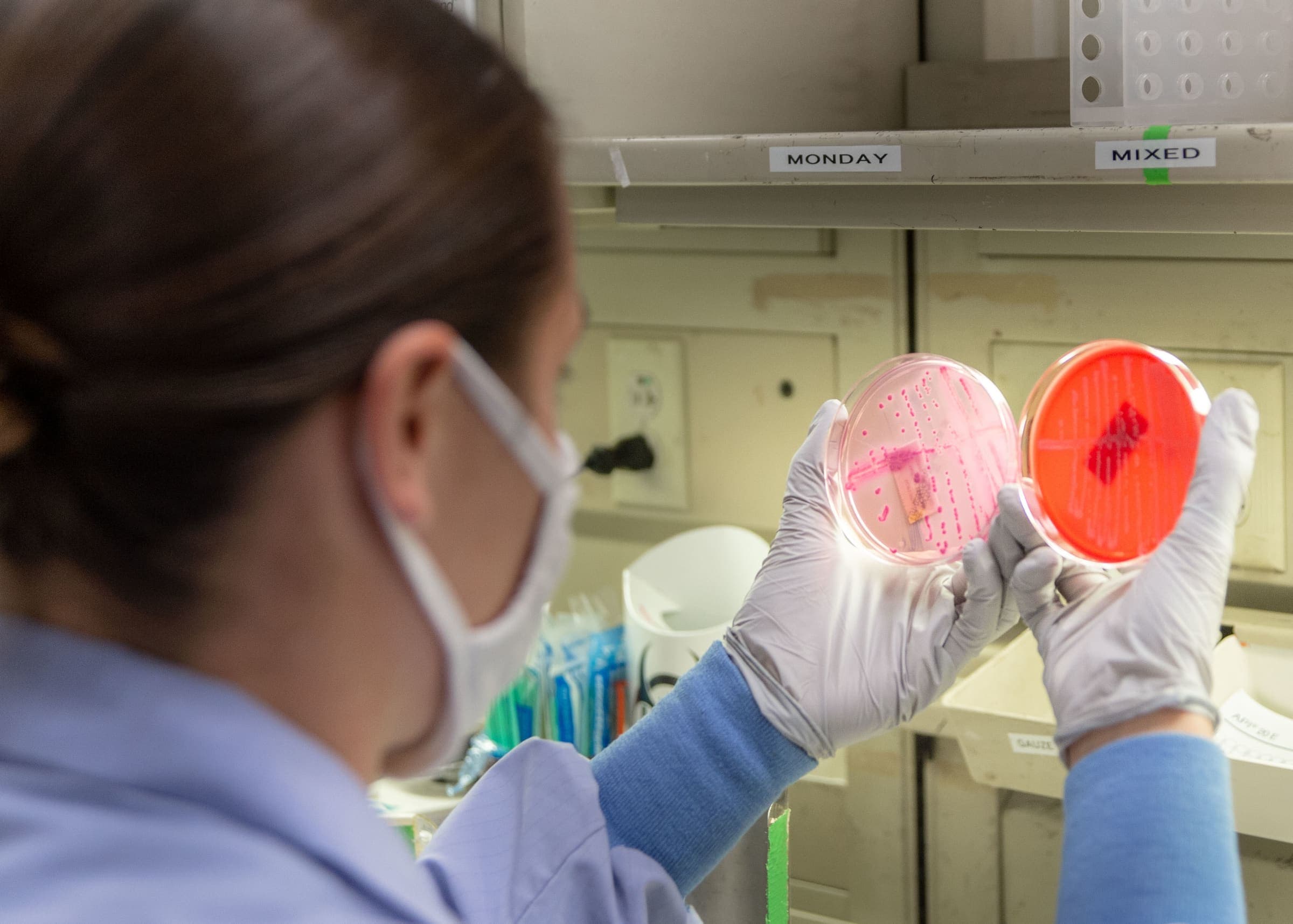 A’dan Z’ye Strep-A (Beta) Bakterisi