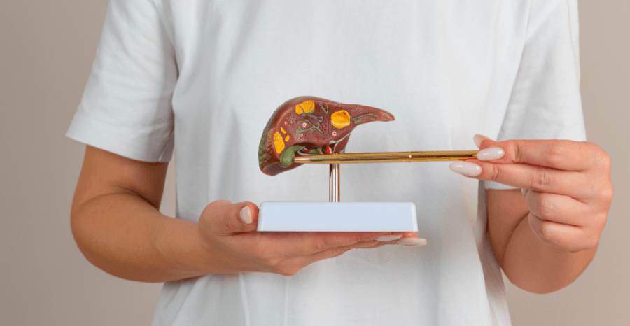 Gallstones