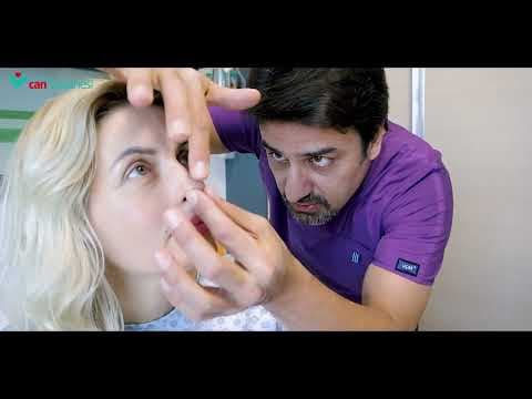 Op. Dr. Burak Kocagözoğlu videosunun kapak görseli