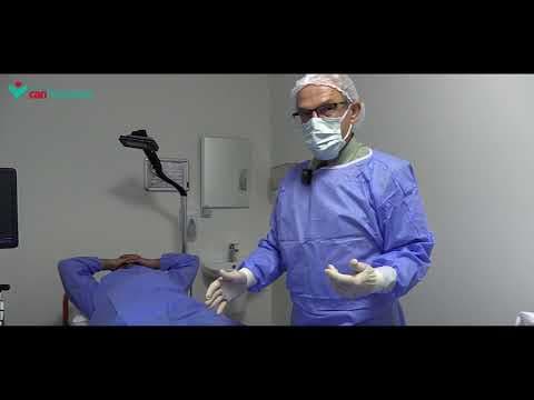 Cover image for the video Varicose Vein Treatment with Medical Adhesive (Glue) - İzmir Özel Can Hastanesi