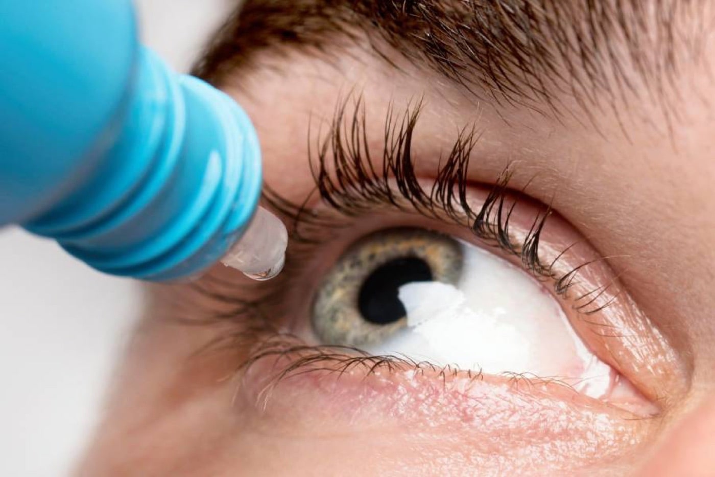 What Is Allergic Conjunctivitis (Pink Eye)?