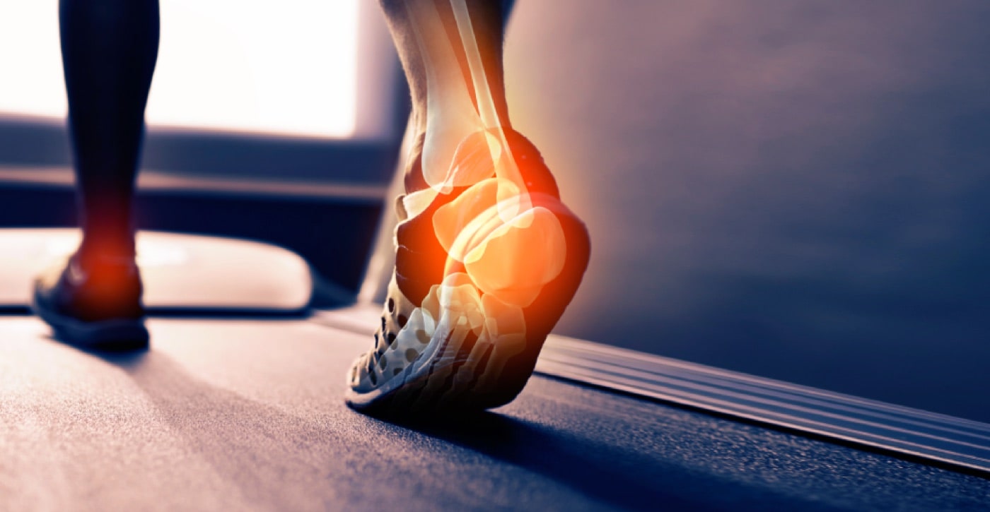 Achilles Tendinitis