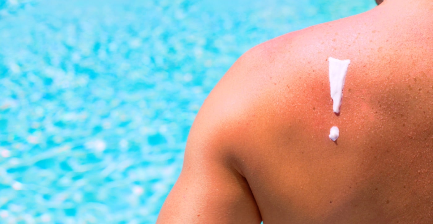 How Can We Protect Ourselves from Sunburn?