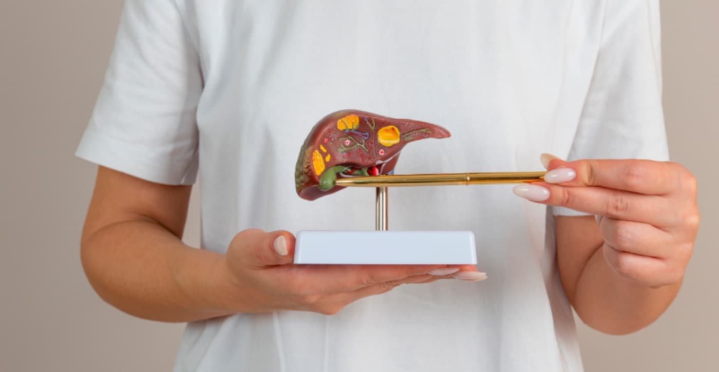 Gallstones