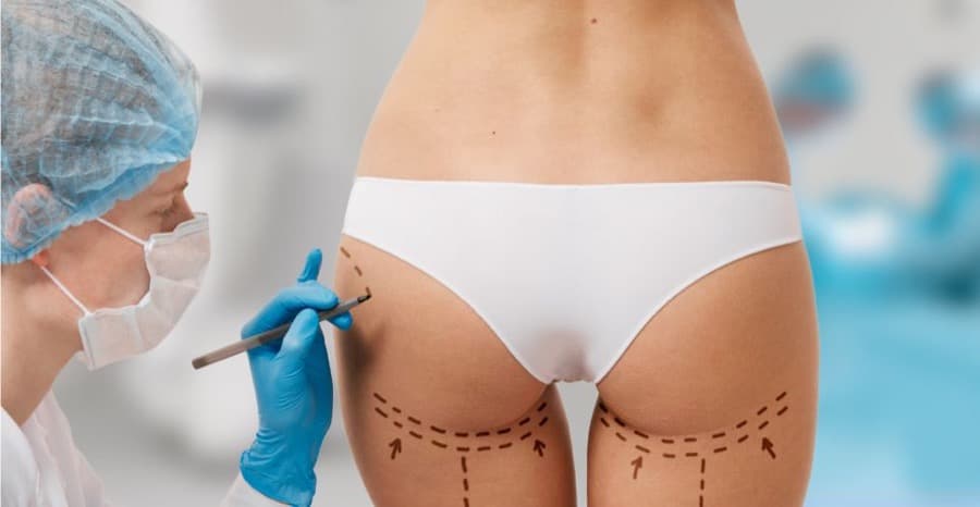 How Is Buttock Augmentation (BBL) Surgery Performed?