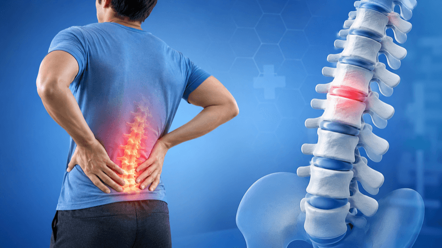 Spinal Disc Diseases and Lower Back Health
