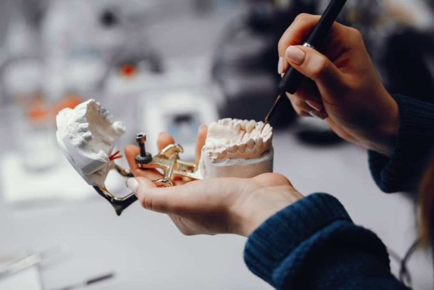 4 Things to Consider Before Getting Dental Implants