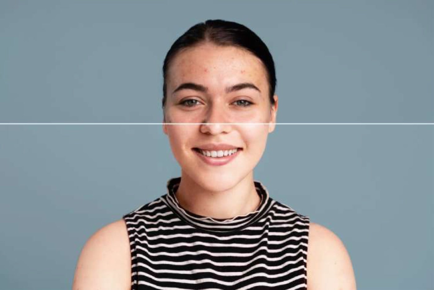 13 Tips to Help You Get Rid of Teenage Acne