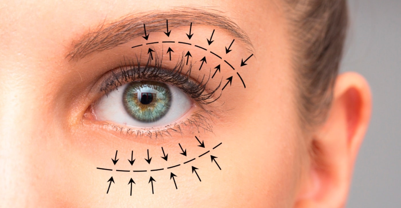 Eye Area Aesthetics