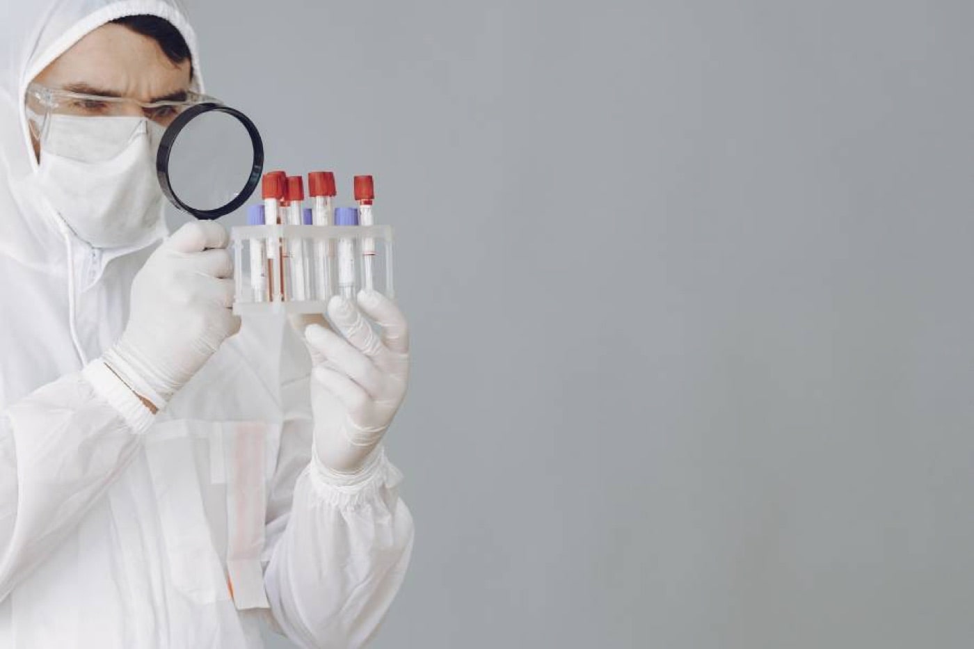 What Is Low Blood Creatinine and How Is It Treated?