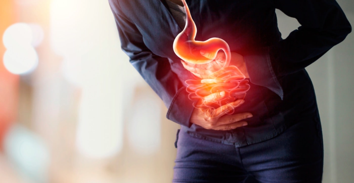 Reflux (Gastroesophageal Reflux/GER)