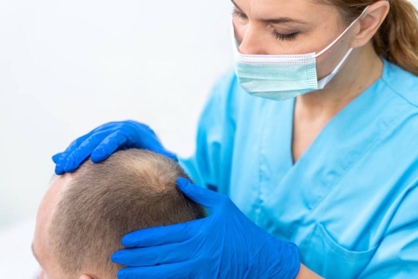 What Should You Pay Attention to After a Hair Transplant?