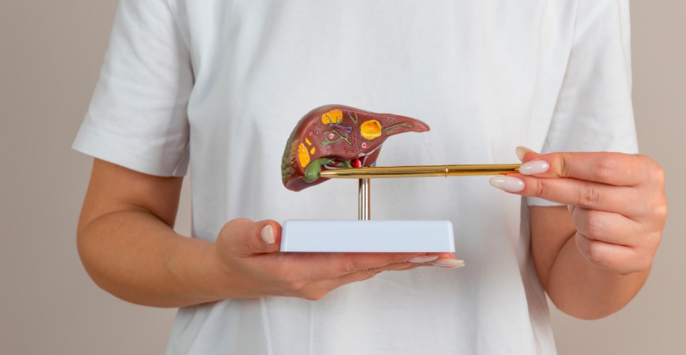 Gallstones