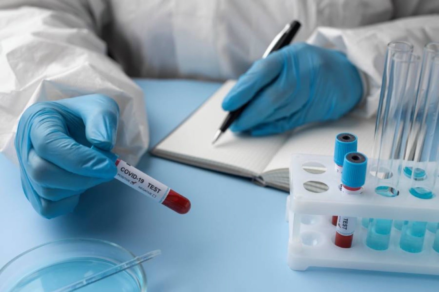 What You Need to Know About High Triglycerides